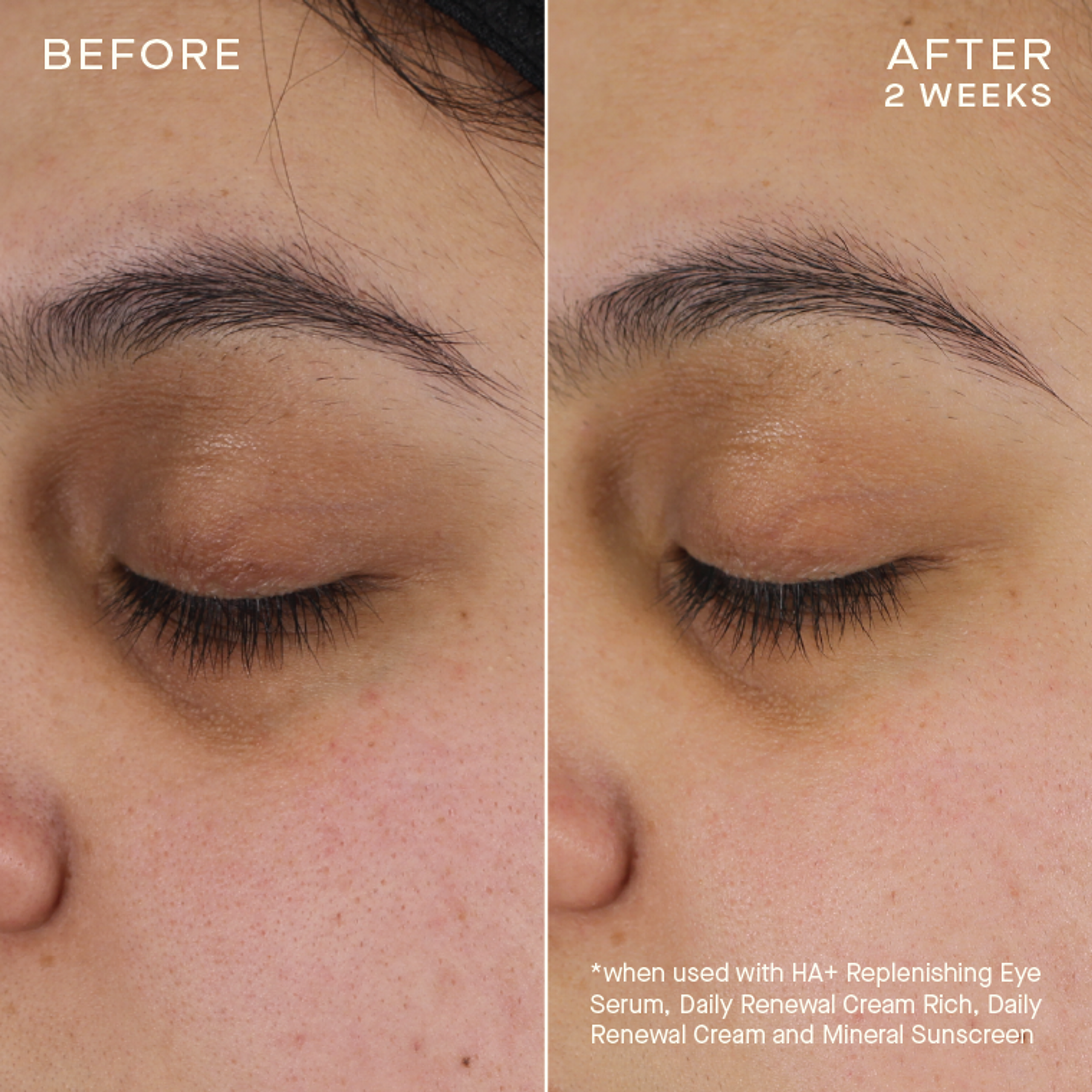 HA+ Replenishing Eye Serum
