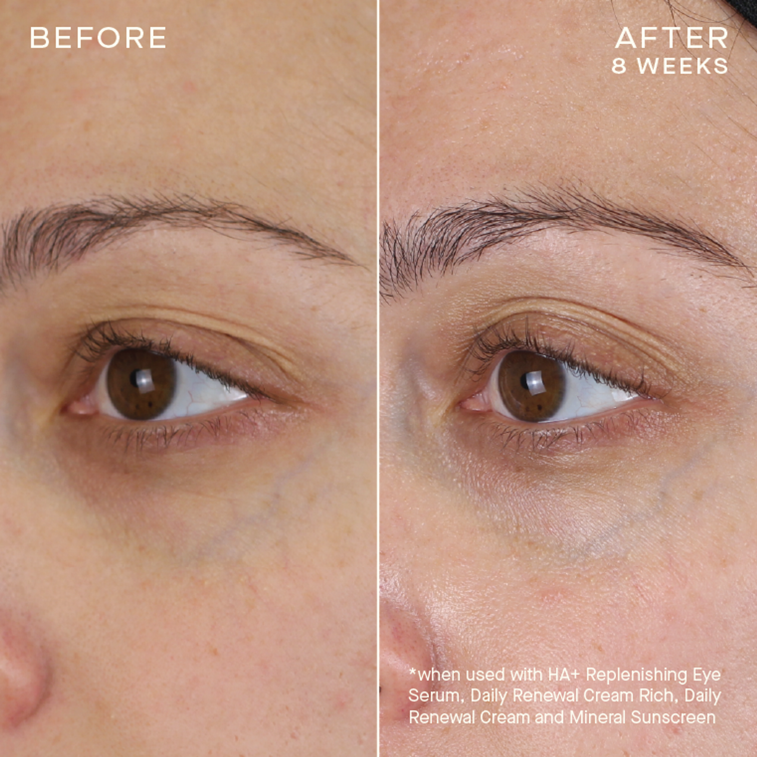 HA+ Replenishing Eye Serum