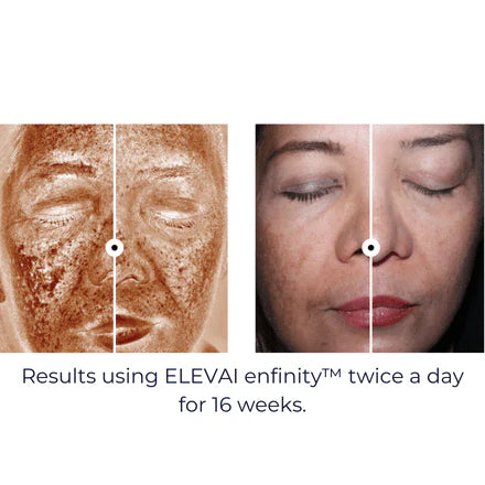 Enfinity Serum