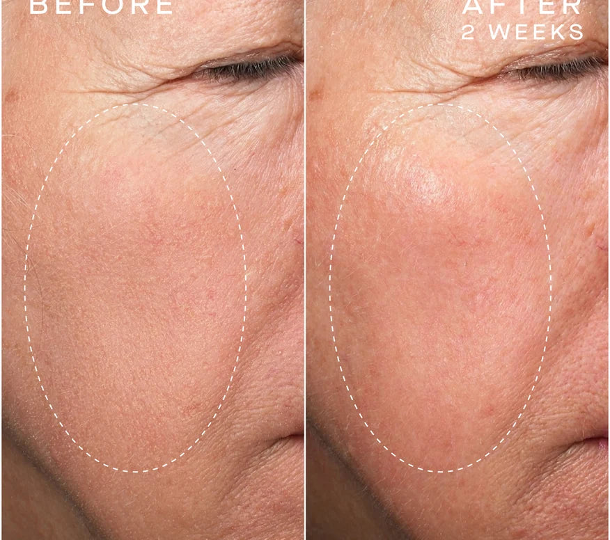 Advanced Regenerative Serum 15mL