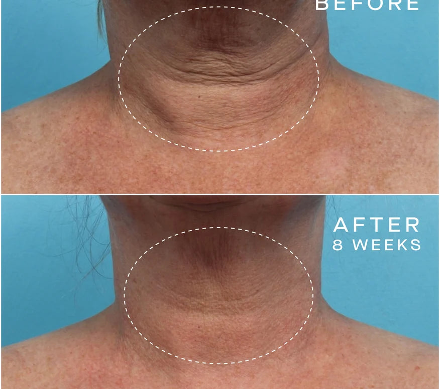 Advanced Regenerative Serum 15mL
