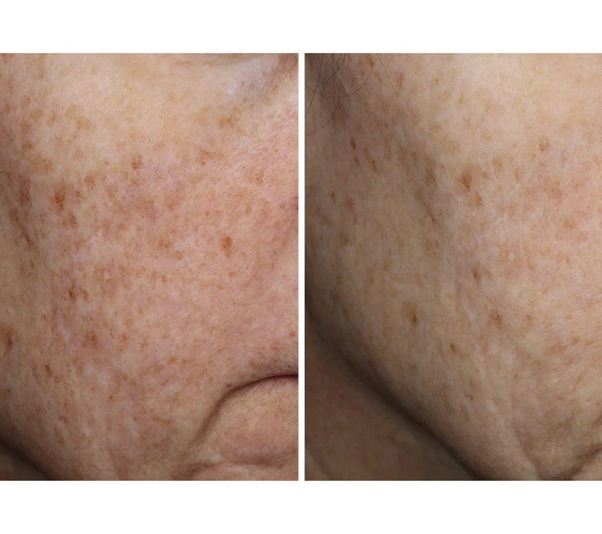 Complexion Brightening Serum