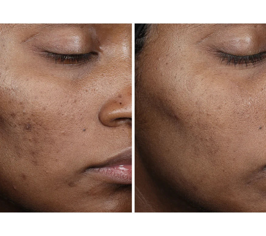 Collagen Reset Regimen