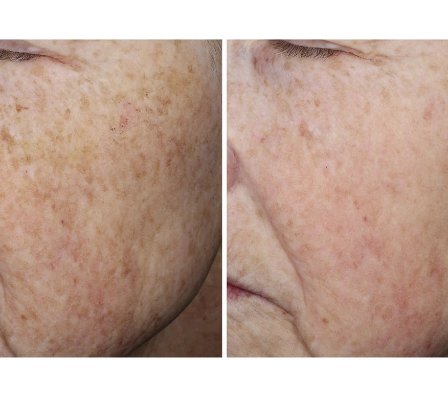 Collagen Reset Regimen