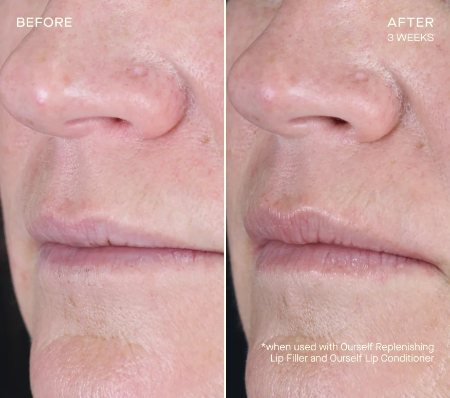 Replenishing Lip Filler