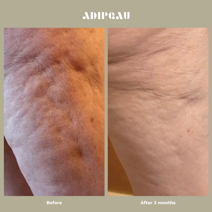 Adipeau - Strength Gel