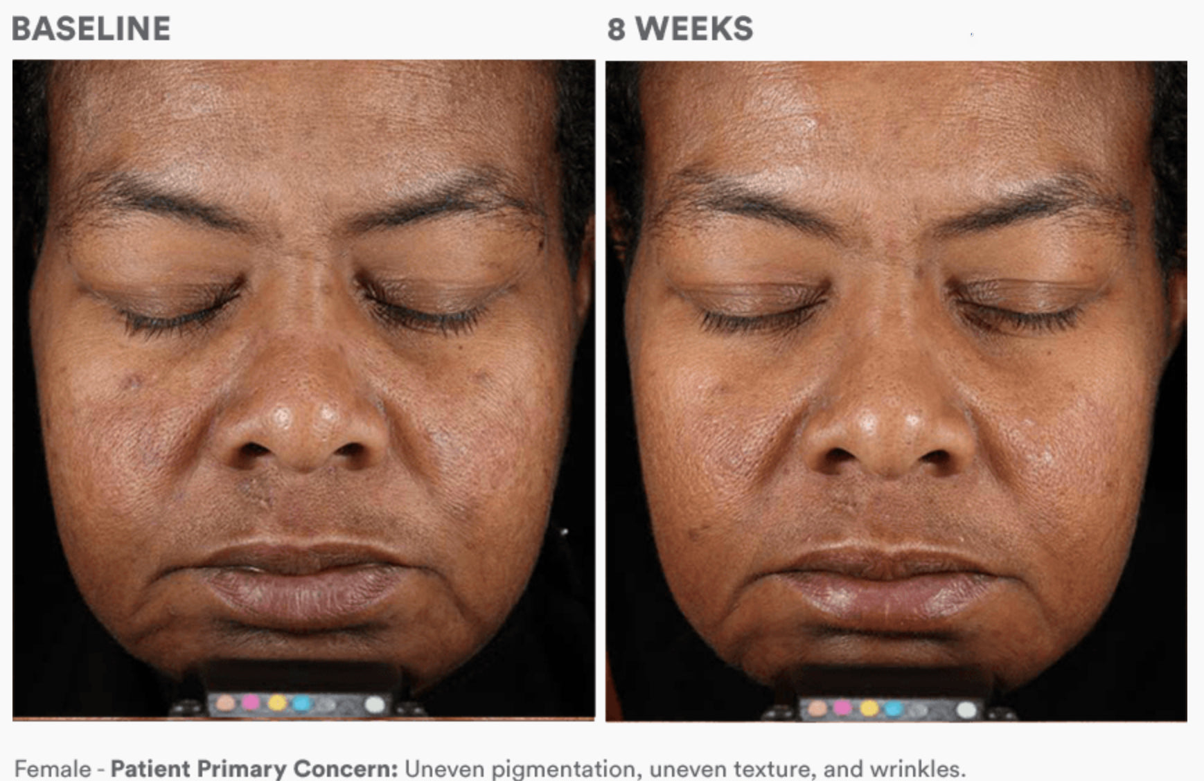 Dermal Repair Cream
