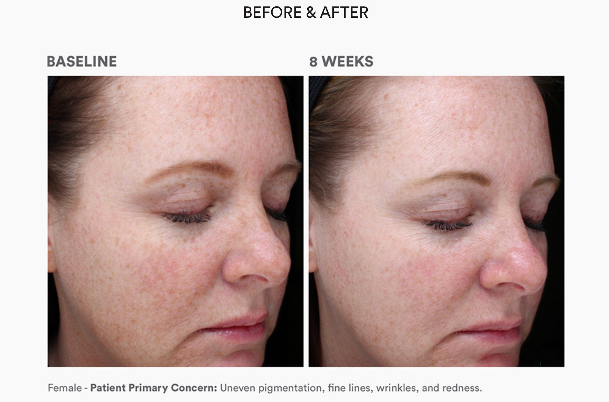 Bio Complete Serum