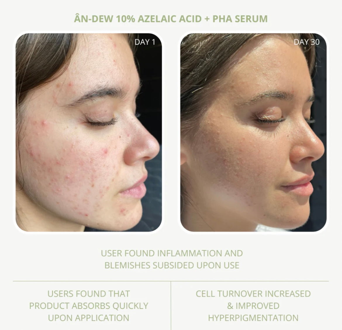ÂN-DEW 10% Azelaic Acid + PHA Serum
