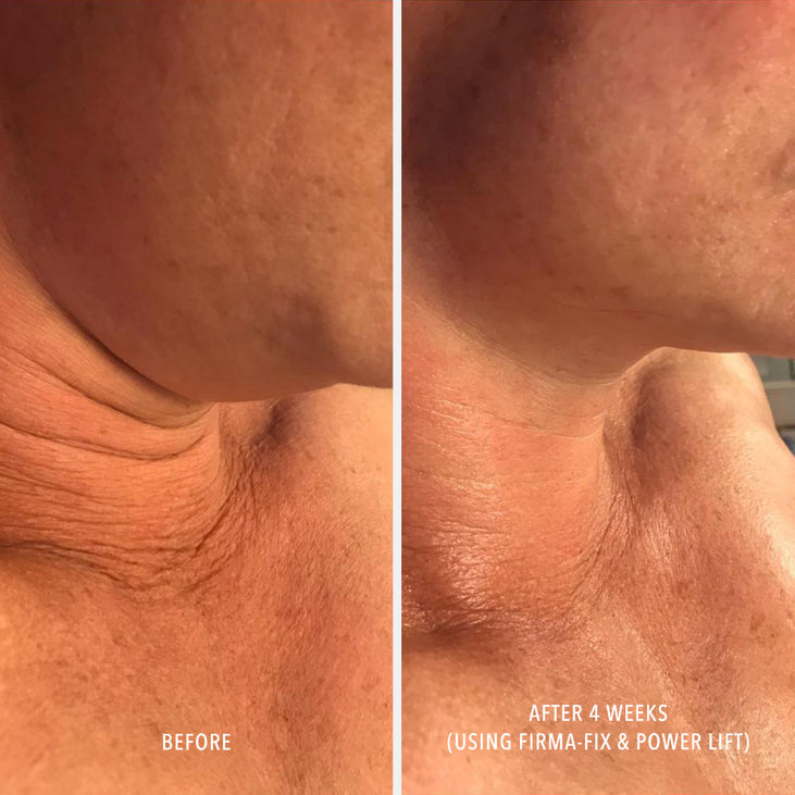 FIRMA-FIX NECTAR - Lifting Neck & Décolleté Serum