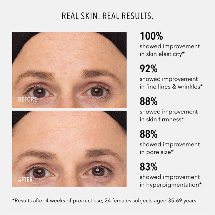 RETINOL ROUTINE BOOSTER - 1% Retinol Solution