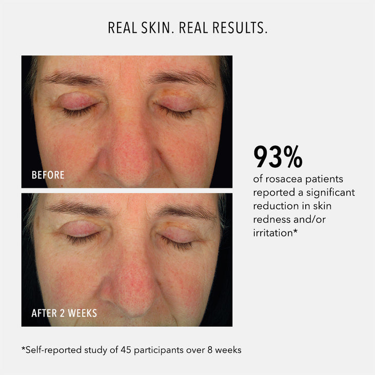 SOOTHING SERUM - Redness Repair & Relief