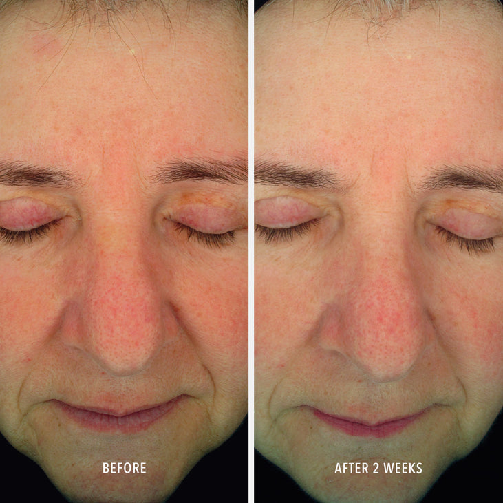 SOOTHING SERUM - Redness Repair & Relief