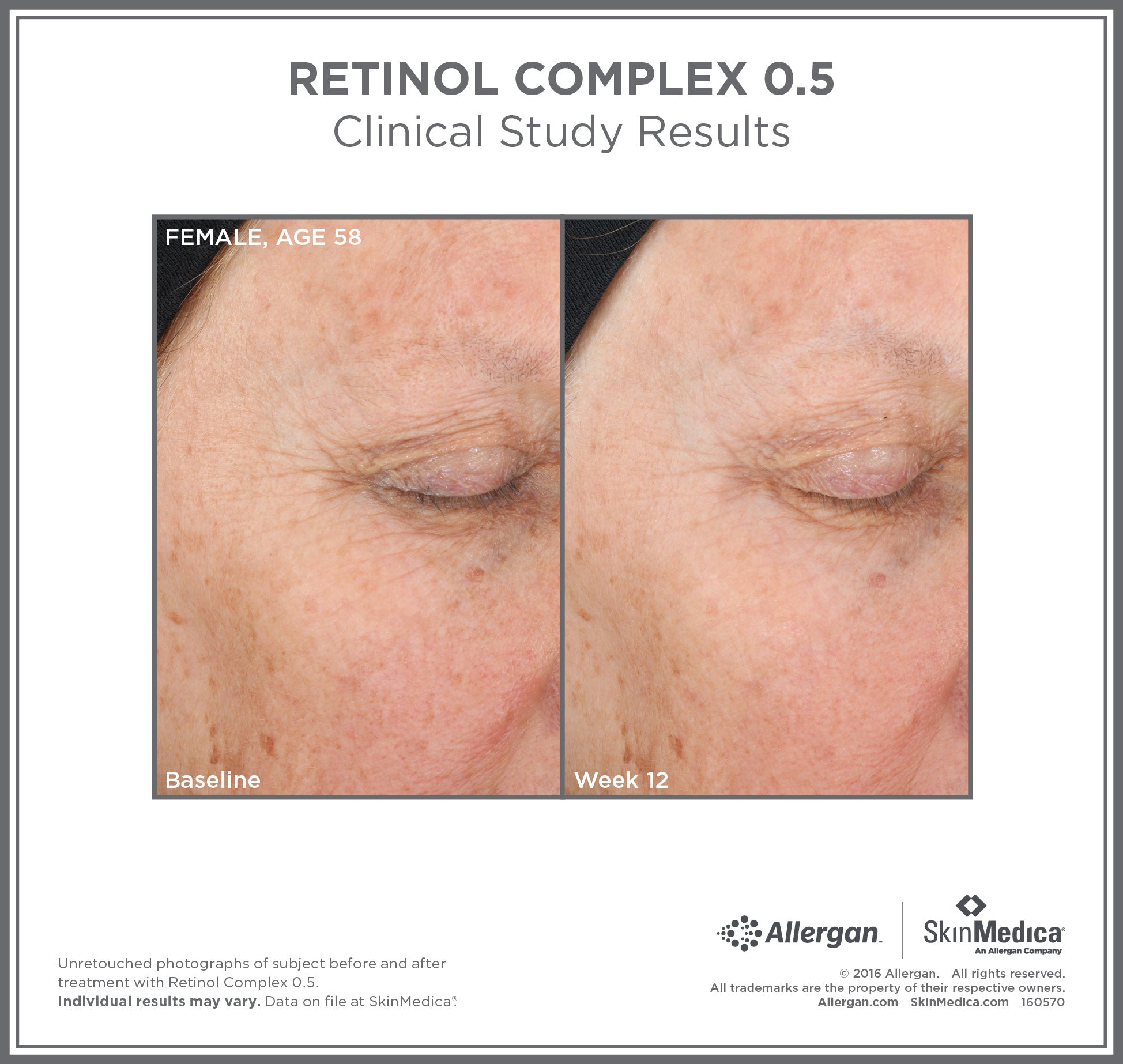 SkinMedica Age Defense Retinol Complex 0.5