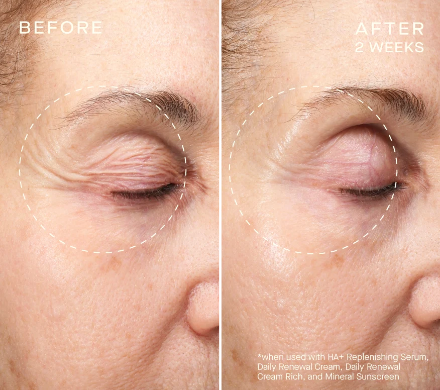 Collagen Reset Regimen