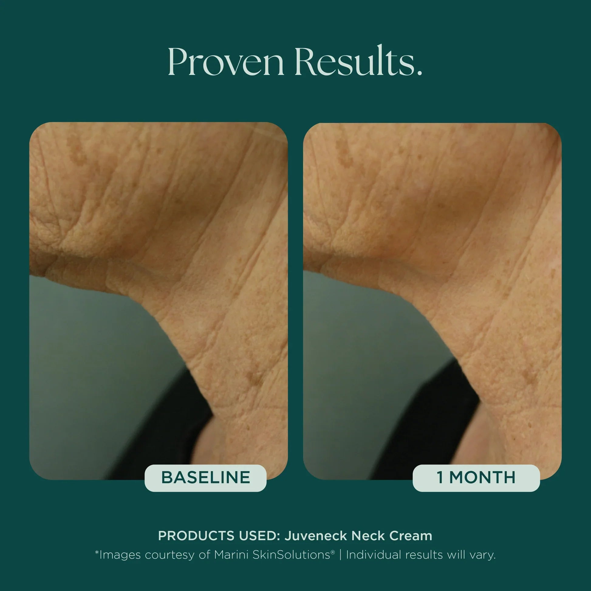 Juveneck Neck Cream