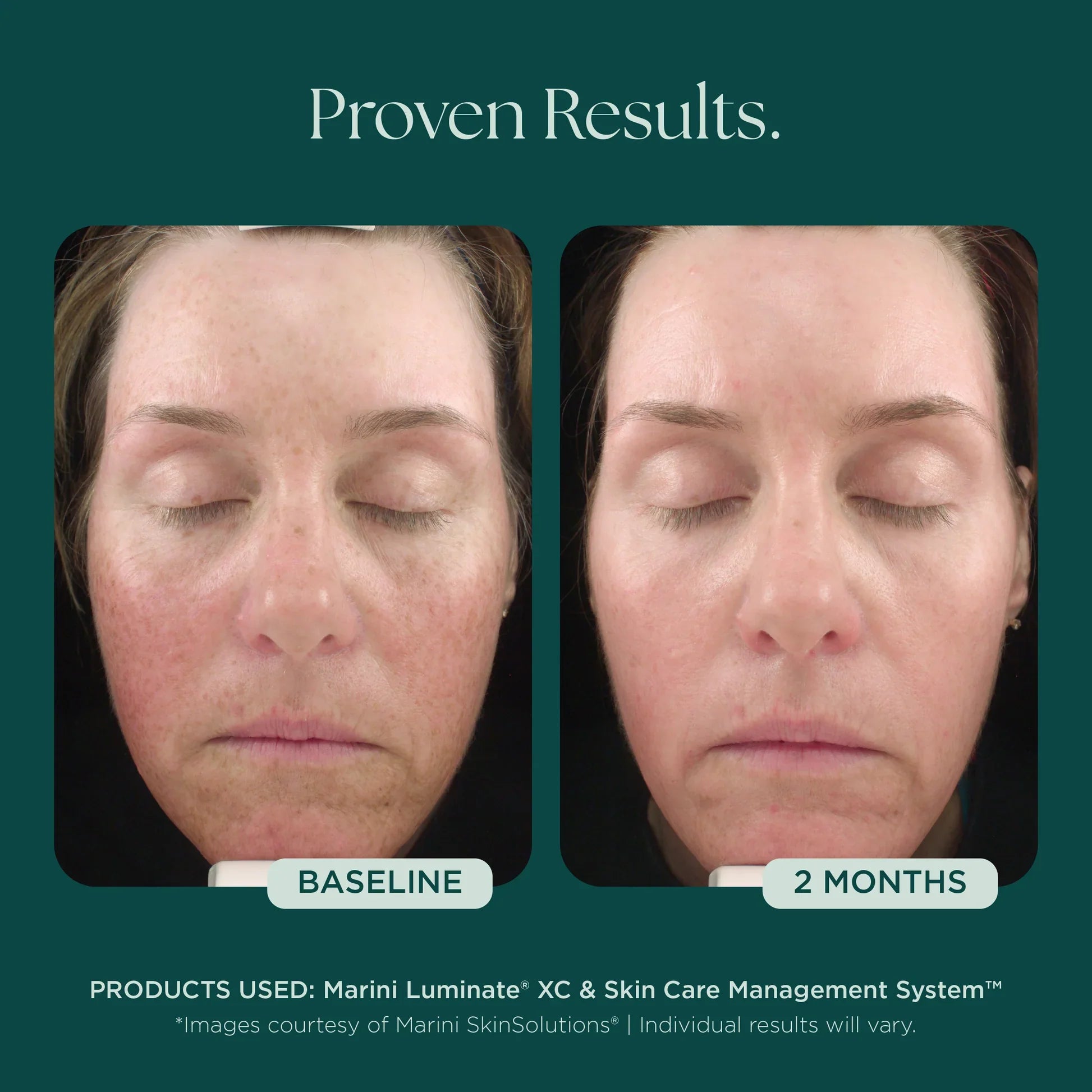Marini Luminate®
