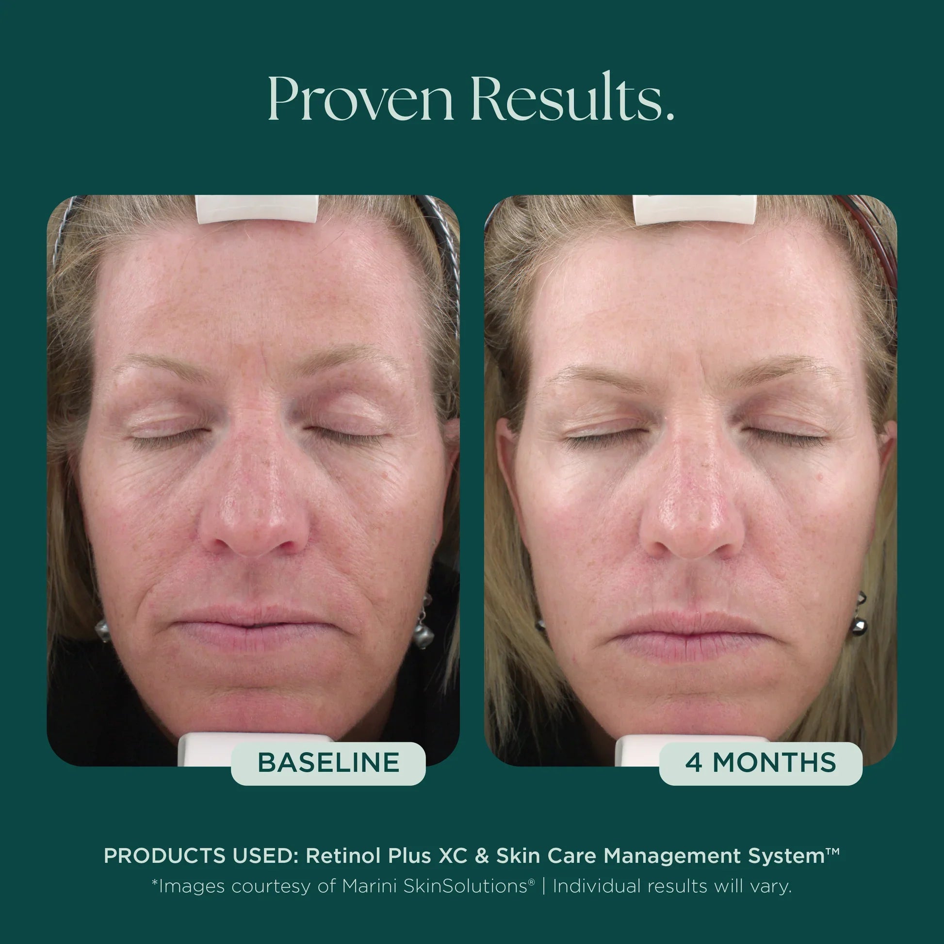 Retinol Plus XC