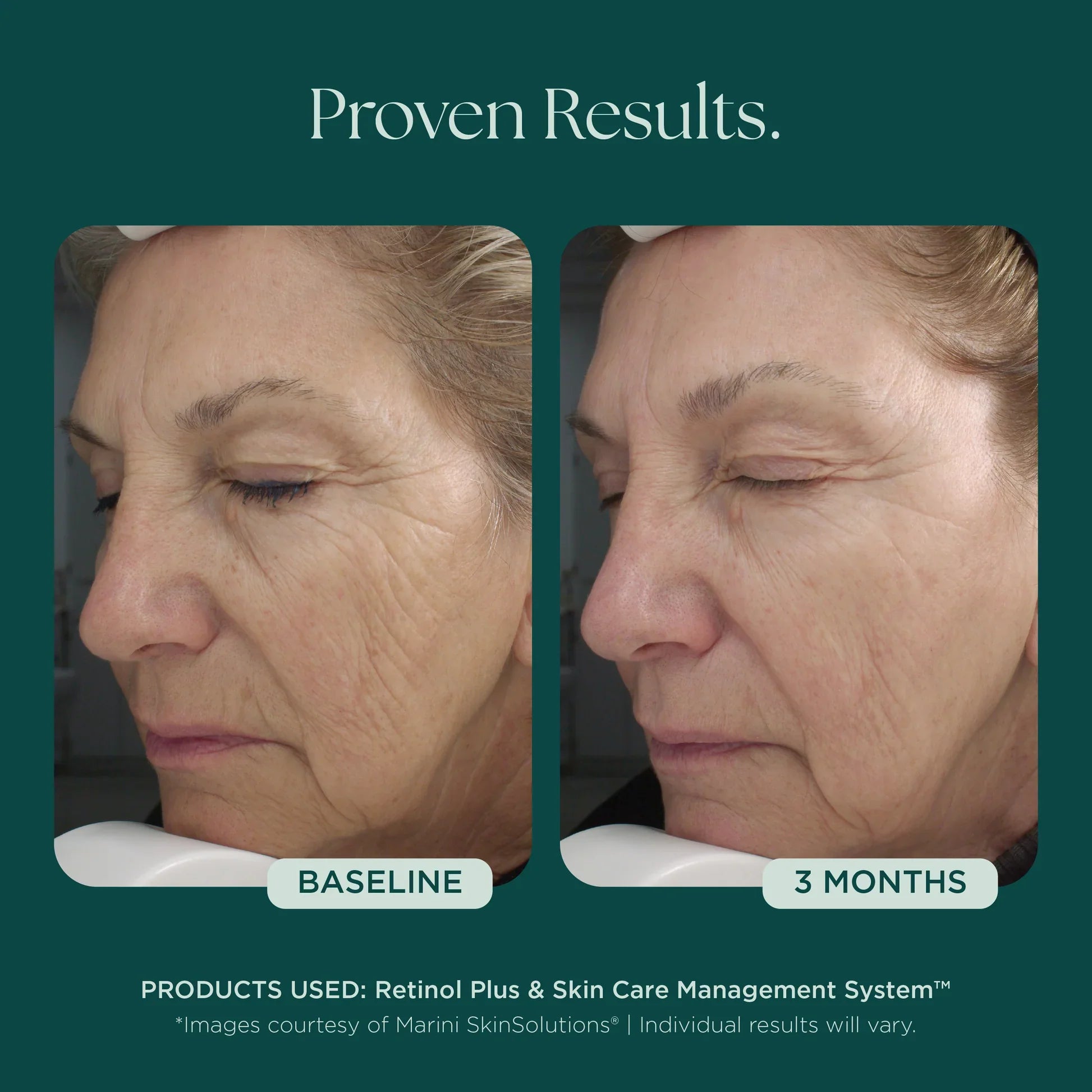 Retinol Plus XC