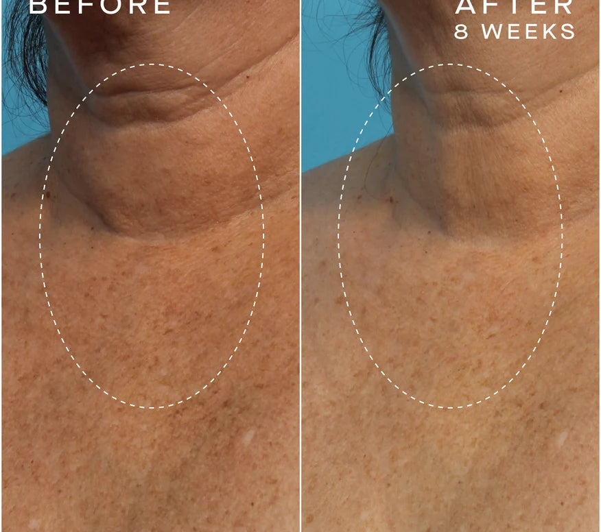 Advanced Regenerative Serum 15mL