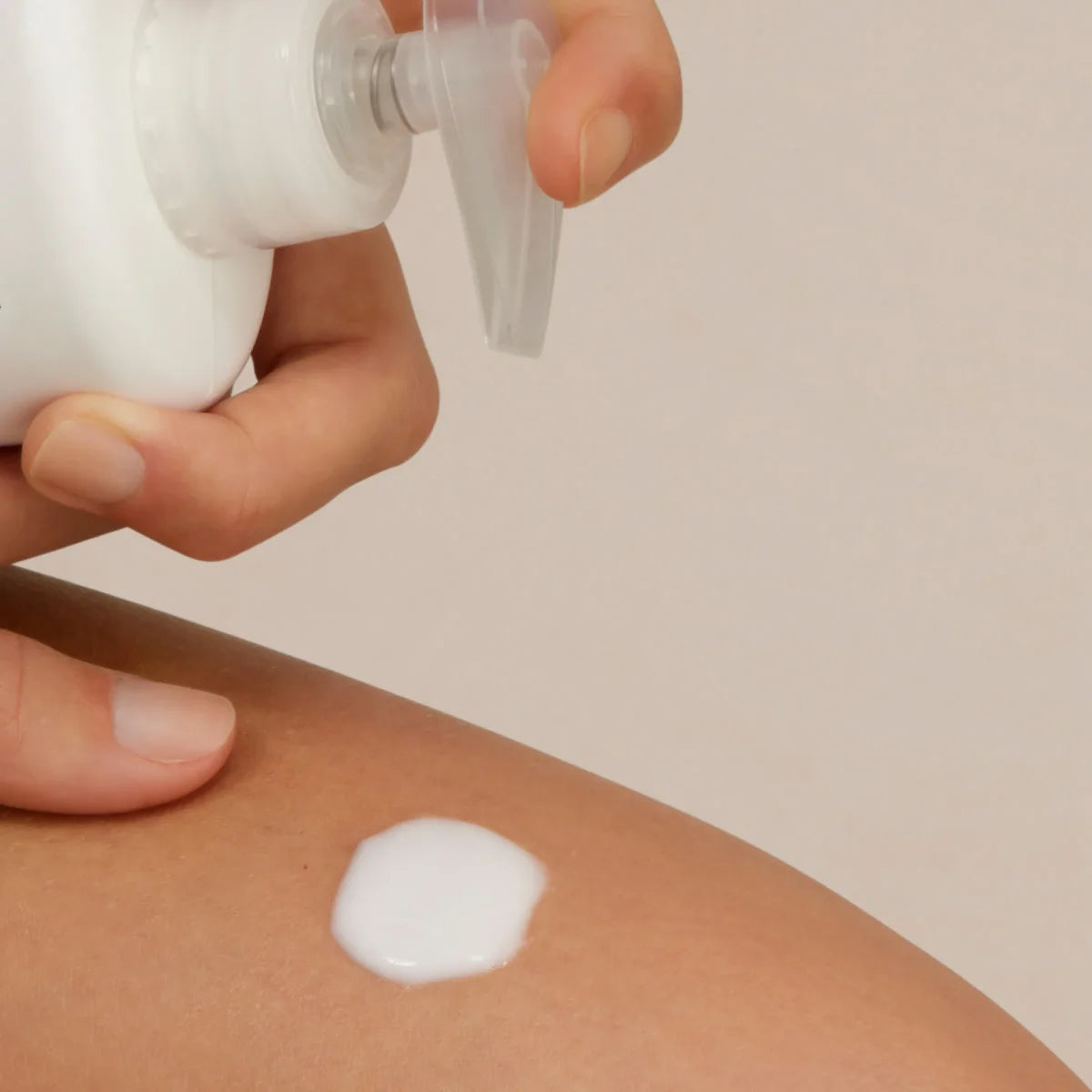 Uradin® Lotion 10