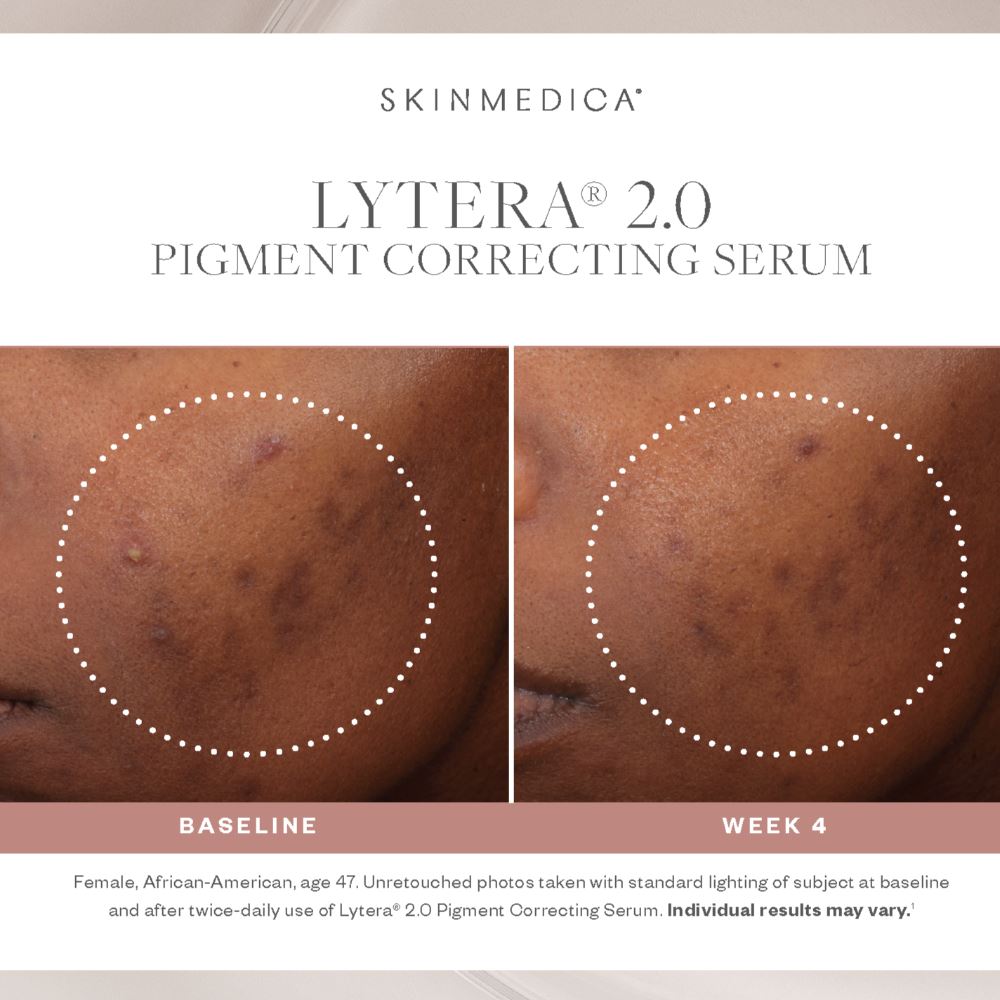 SkinMedica Lytera 2.0 Pigment Correcting Serum