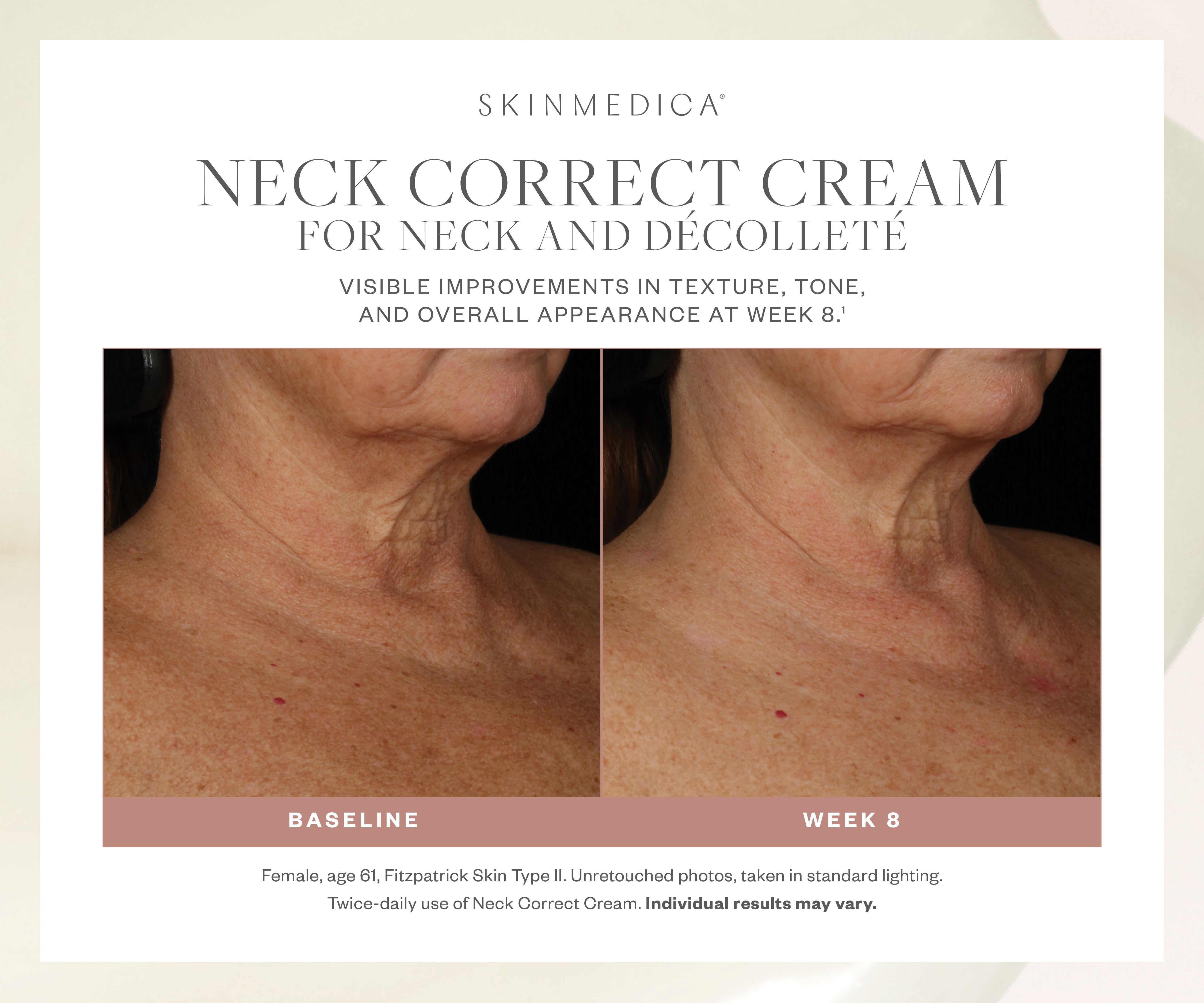 SkinMedica Neck Correct Cream