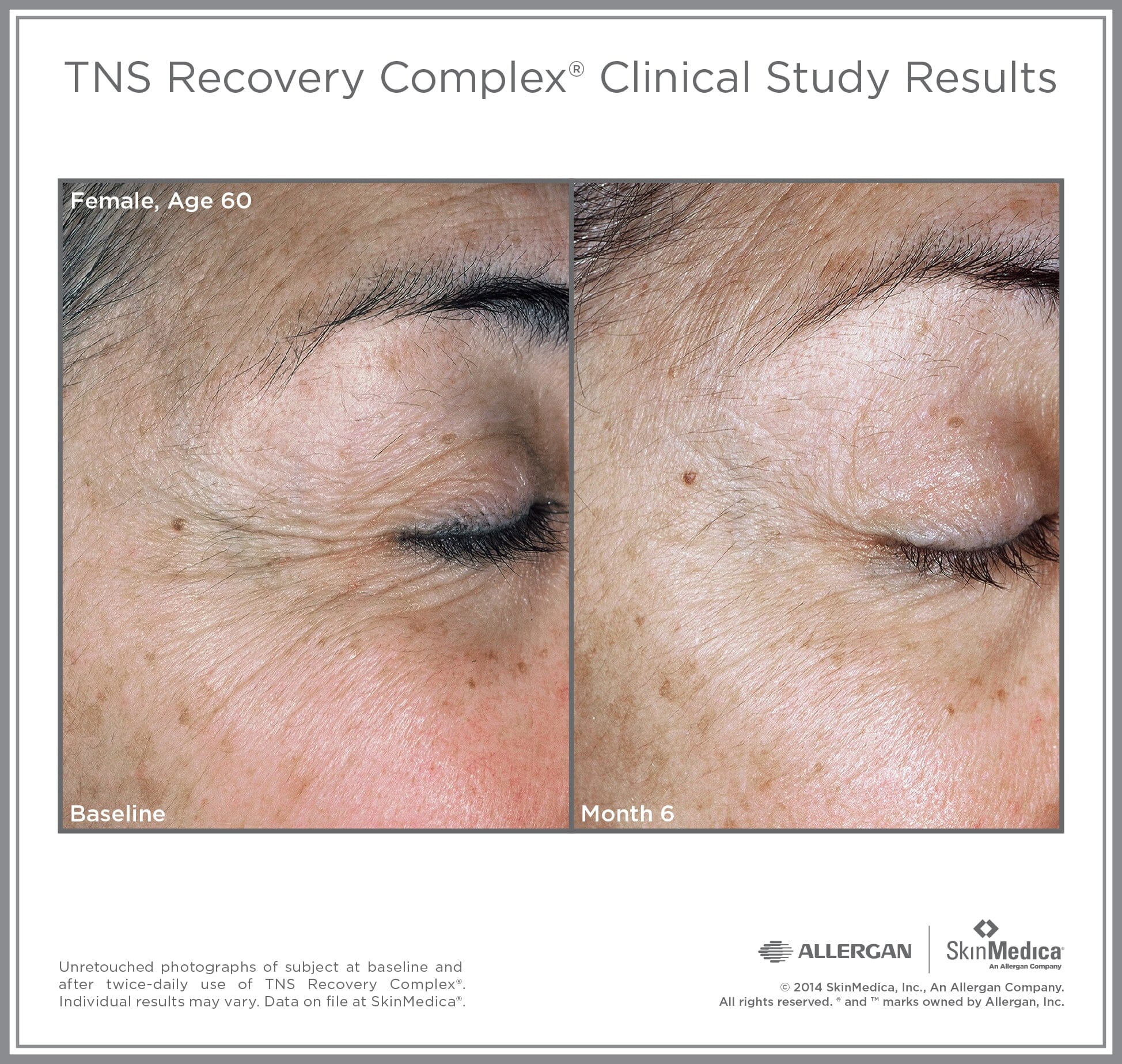 SkinMedica TNS Recovery Complex