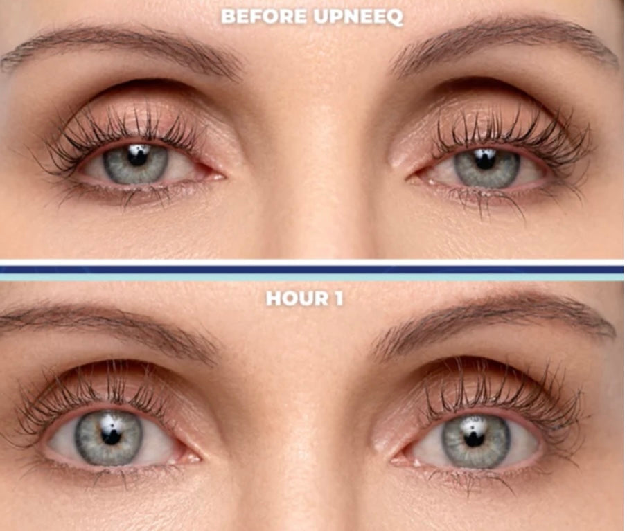 UPNEEQ Eye Opening Treatment